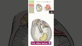 Concerns about middle ear atelectasis  When to operate earsurgery [upl. by Aidnyc]