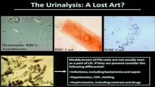 The Management of Lupus Nephritis A Nephrologists Perspective [upl. by Paulson]