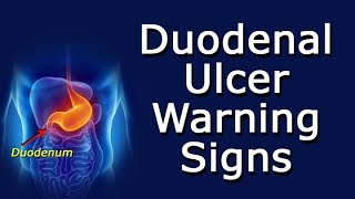 Duodenal Ulcer Warning Signs [upl. by Gwyneth]