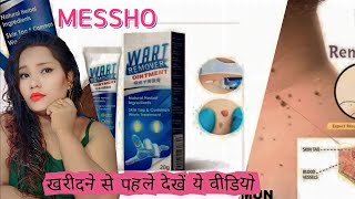 Wart Remover Review 2023 Instant Blemish Removal Gel [upl. by Kobi479]