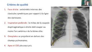 Radiographie thoracique [upl. by Asetal]