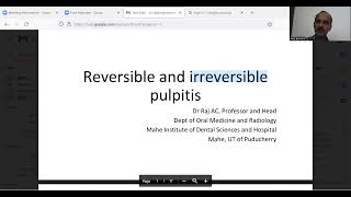 REVERSIBLE and IRREVERSIBLE PULPITIS  Dr raj AC  Department of Oral Medicine and Radiology [upl. by Azeria]