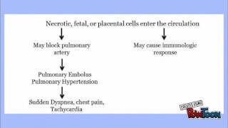 Amniotic Fluid Embolism [upl. by Tica]