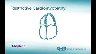 Echocardiography Restrictive Cardiomyopathy with Examples and Echo Demonstration [upl. by Corella]