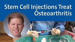 Stem Cell Injections Treat Osteoarthritis  Duke Health [upl. by Rodnas]