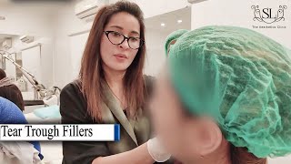 Tear Trough fillers  Under Eye Treatment  Dr Shaista lodhi from The Aesthetics Clinic [upl. by Afira]