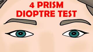 4 PRISM DIOPTRE TEST [upl. by Meneau553]