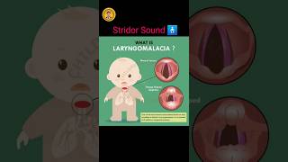 Laryngomalacia sound 🩺⚕ viral doctor shortvideo aiims human [upl. by Ednalrym]