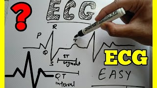 How to Read ECG in Hindi easy wayECG reading in Hindi ECG interpretation make easy ECG [upl. by Franzoni169]