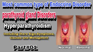 Hyperparathyroidism  Parathyroid gland Disorder By AbuBakar Med Plus [upl. by Daggna]