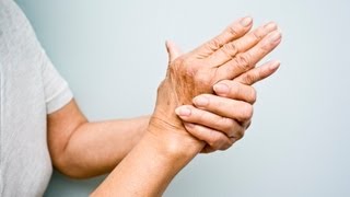 What is Rheumatoid Arthritis [upl. by Kiah358]