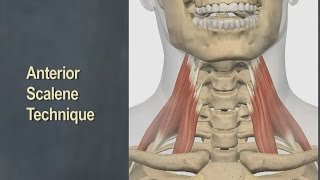 Therapeutic Massage for Anterior Scalene Muscles [upl. by Nilcaj]