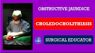 CHOLEDOCHOLITHIASISHow To DIAGNOSE amp TREAT Obstructive Jaundice [upl. by Garbers]