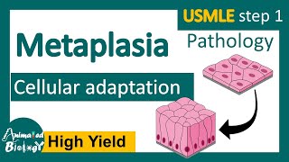 Metaplasia  Cellular adaptation  examples of metaplasia [upl. by Halihs]