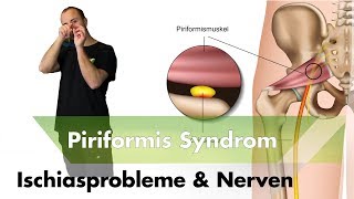 Ischialgie amp Piriformissysndrom  Nervensystem  Das solltest du über Schmerzen wissen [upl. by Durrej930]