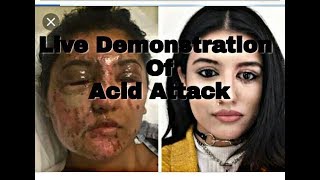 ACID ATTACK LIVE DEMONSTRATION BY SULFURIC ACID AND PREVENTION FROM ACID ATTACK [upl. by Onaireves]