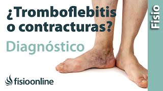 Cómo diferenciar una tromboflebitis de un dolor muscular de la pantorrilla o contractura muscular [upl. by Noach]