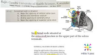 Anatomy Thorax 288 SinoAtrial Node location SinuAtrial Heart SVC Solved Question Paper MCQ [upl. by Aneehta670]