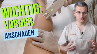 Haarentfernung mit Laser oder IPL Ablauf Erfolge Risiken und Tipps von Dr Robert Kasten Mainz [upl. by Econah]