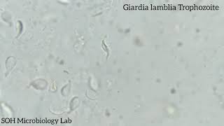 Giardia lamblia Trophozoite in stool [upl. by Weixel]