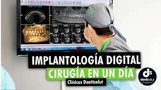 🦷 Implantes dentales  Cirugía en un día  Implantología Digital 🦷 [upl. by Etaner]