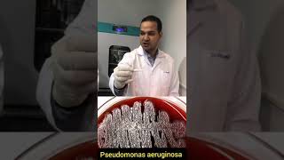 Oxidase test for Pseudomonas aeruginosa 🆚 Enterobacteriaceae شرح بالعربي إجراء اختبار الاوكسديز [upl. by Raddy]