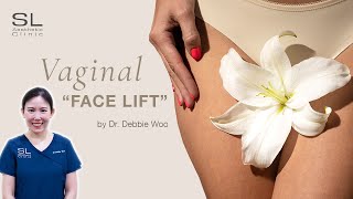 🌸 All About Laser Vaginal Tightening amp Rejuvenation 🙆‍♀️ doctor aesthetic sexualwellbeing [upl. by Willett]