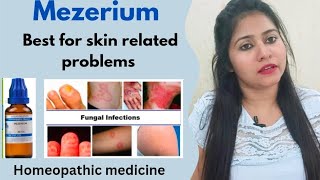 Mezereum Homeopathic medicine uses amp benefits  Mezereum best for skineye amp respiratory problems [upl. by Migeon564]