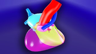 Tetralogy of Fallot  3D Animated Visual Lecture [upl. by Asilahs186]