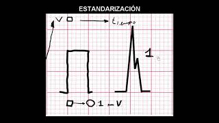 10 STANDARIZATION PAPER SPEED AND AMPLITUDE  ELECTROCARDIOGRAPHY ECG ONLINE COURSE [upl. by Batory]