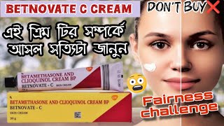 BETNOVATE C CREAM SIDE EFFECTS⁉️ Betnovate C Cream Review  এই ক্রিম টি কতটা ভালো জেনে নাও‼️ [upl. by Cristabel]