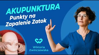 Punkty Na Zapalenie Zatok Czemu Służy Akupunktura Poznaj Podstawy Akupunktury [upl. by Kifar]