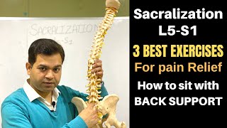 Sacralization L5S1 3 Best Exercises For Back Pain Relief SI Joint Pain exercises [upl. by Towrey]