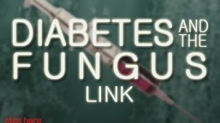 Diabetes  Know The Cause  With Doug Kaufmann [upl. by Enelyad208]