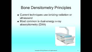 Bone Densitometry [upl. by Ielarol]