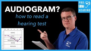 Audiogram  How to Read a Hearing Test [upl. by Nannek]