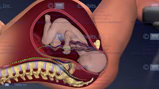 Umbilical Cord Compression and the Interactive Fetal Monitoring Strip Viewer [upl. by Aissatsana145]