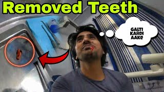 अकल दार्द वाले दांत को निकलवा दिआ  REMOVED TEETH  🥲🦷🦷 [upl. by Sayed]