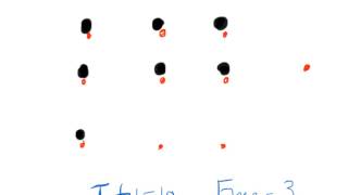 Understanding Total vs Free Phenytoin [upl. by Easton724]