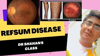 Refsum Disease  Retinitis Pigmentosa  Anosmia  Neuropathy [upl. by Aerdnaeel]