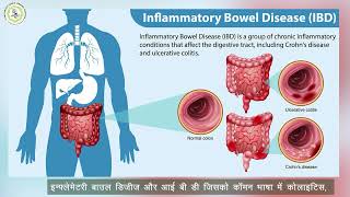 World IBD Day Subharti Hsopital worldibdday [upl. by Ayim]