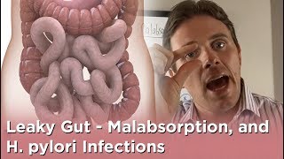 Leaky Gut  Malabsorption and Hpylori Infections [upl. by Trillby241]