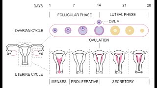 Amenorrhea  Definition Causes Signs and Symptoms Investigation and Management [upl. by Fawne]