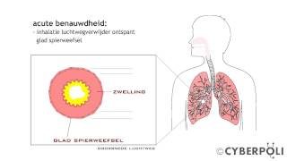 Astma  Behandeling met luchtwegverwijders [upl. by Lyrpa824]