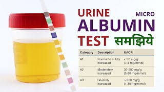 Micro Albumin Urine Test Procedure Results Analysis and Normal Range in Hindi [upl. by Spatola]