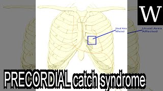 PRECORDIAL catch syndrome  WikiVidi Documentary [upl. by Lydon115]