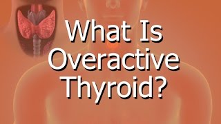 What Is Overactive Thyroid [upl. by Yasu]