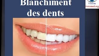 Blanchiment des dents techniques [upl. by Atis257]