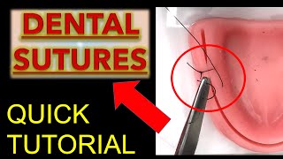 ALL SUTURES Tips to LEARN FAST Dental Suture Techniques  Oral Surgery  Dentistry Suturing [upl. by Watters]