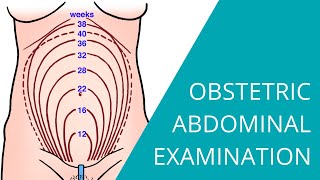 Obstetric Abdominal Examination  Steps for examining a pregnant woman [upl. by Harmonie741]